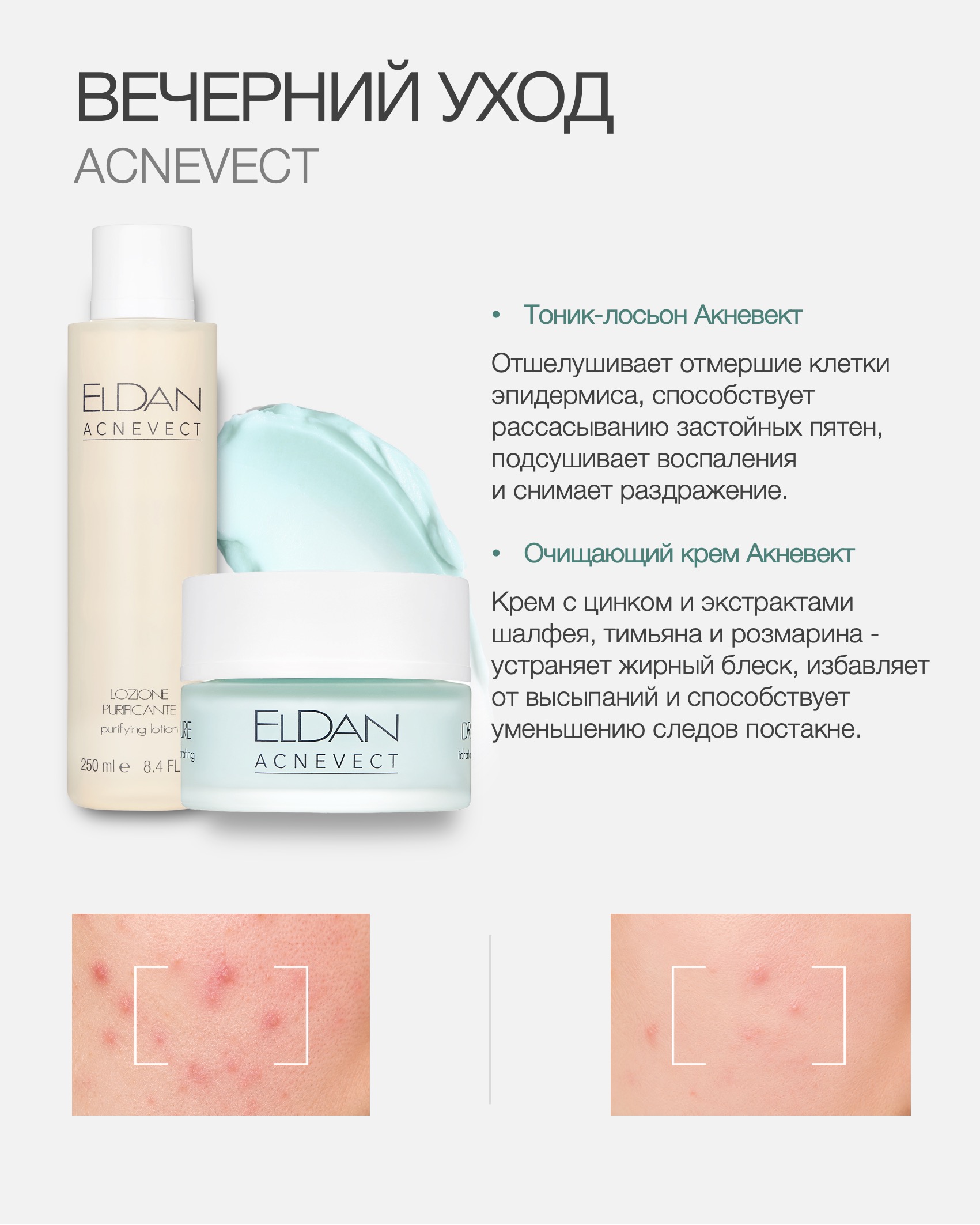 Пост проблем кожа день-вечер 5.jpg